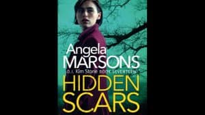 Hidden Scars audiobook